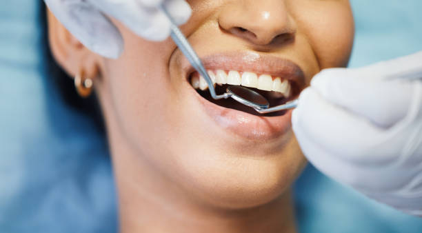 Best Emergency Wisdom Teeth Removal in Crystal Lakes, OH